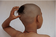 bald child