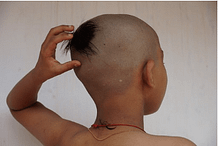 bald child 